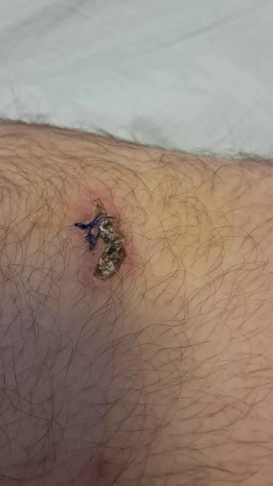 Ayının Saldırısına Uğrayan Çiftçi Dehşet Anlarını Anlattı Parmağımı Kopardı (3)