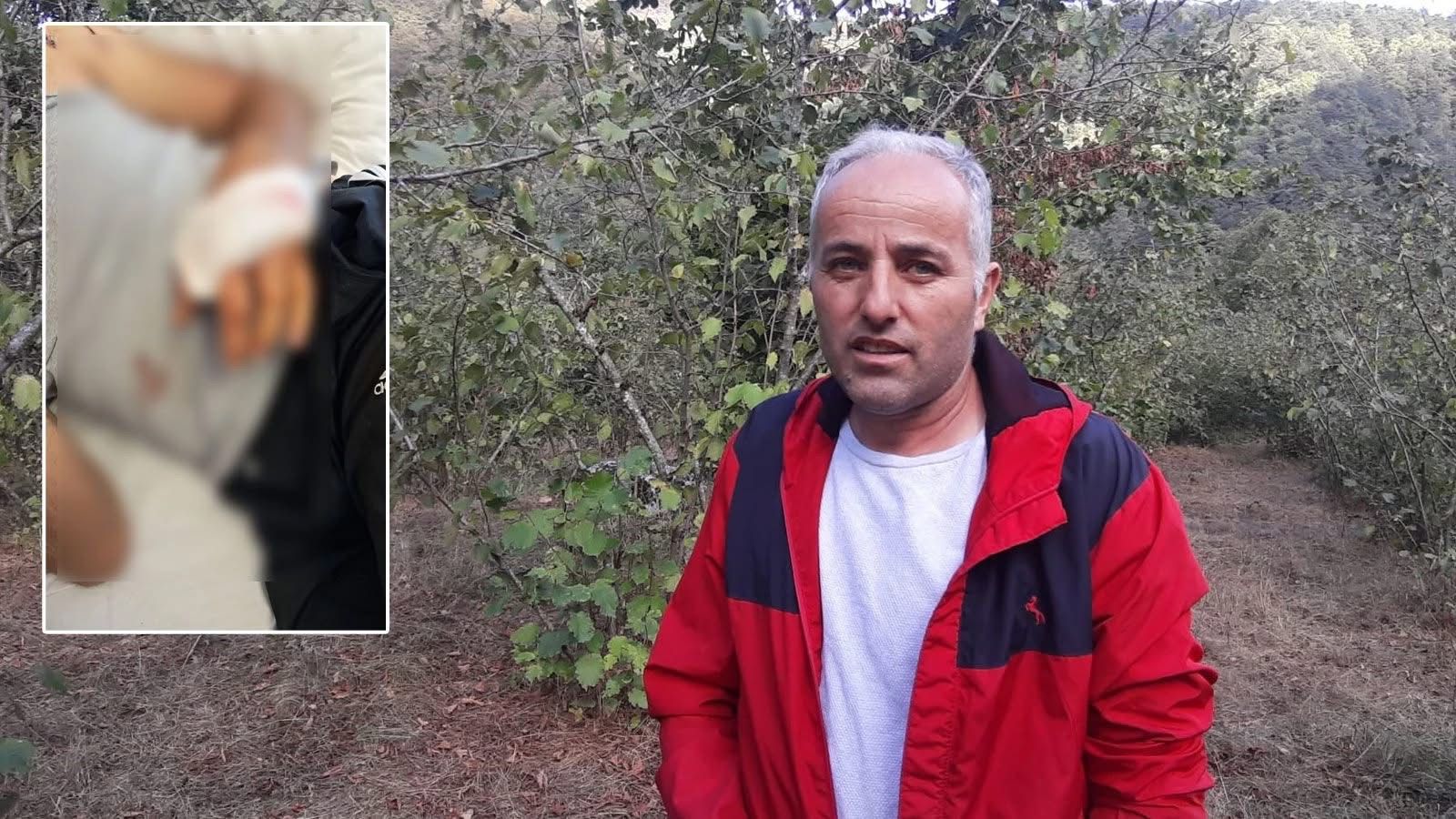 Ayının Saldırısına Uğrayan Çiftçi Dehşet Anlarını Anlattı Parmağımı Kopardı (7)