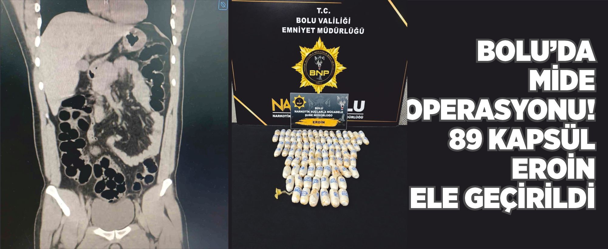 Bolu’da mide operasyonu! 89 kapsül eroin ele geçirildi