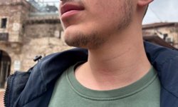 Bolu’da Üzücü Olay: Basın Emekçisine Şiddet