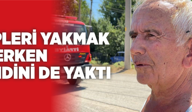 Çöpleri yakmak isterken kendini de yaktı
