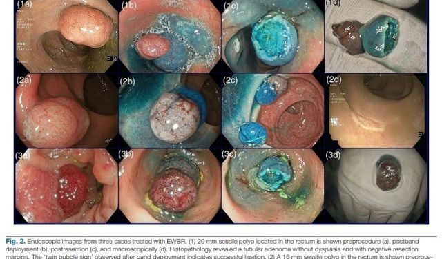 Türk bilim adamının yeni yöntemi uluslararası tıp camiasında kabul gördü