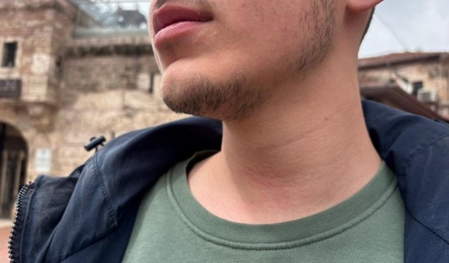 Bolu’da Üzücü Olay: Basın Emekçisine Şiddet