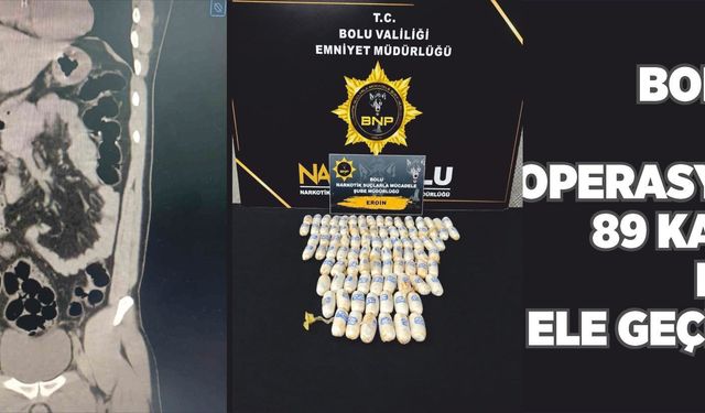 Bolu’da mide operasyonu! 89 kapsül eroin ele geçirildi