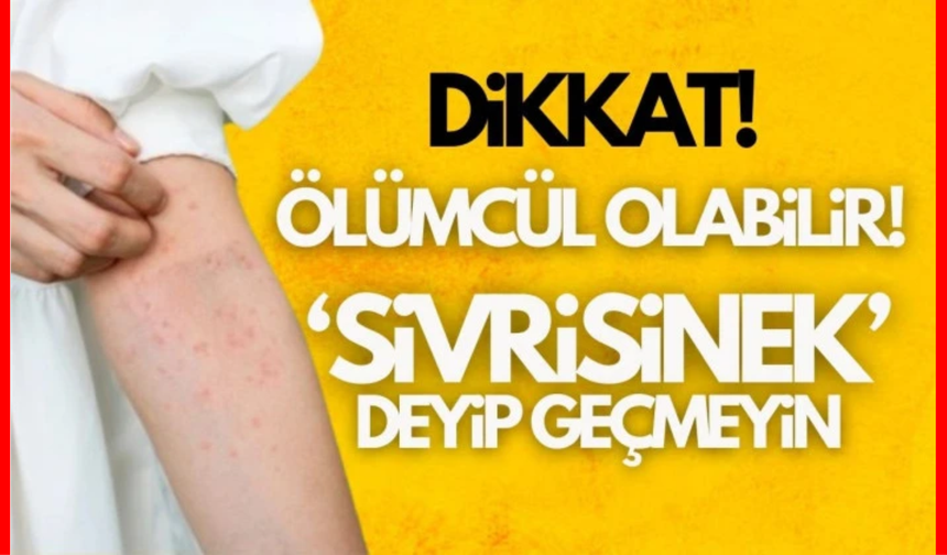 Uzmanı anlattı: Sivrisinek ısırığı ile gelen tehlike